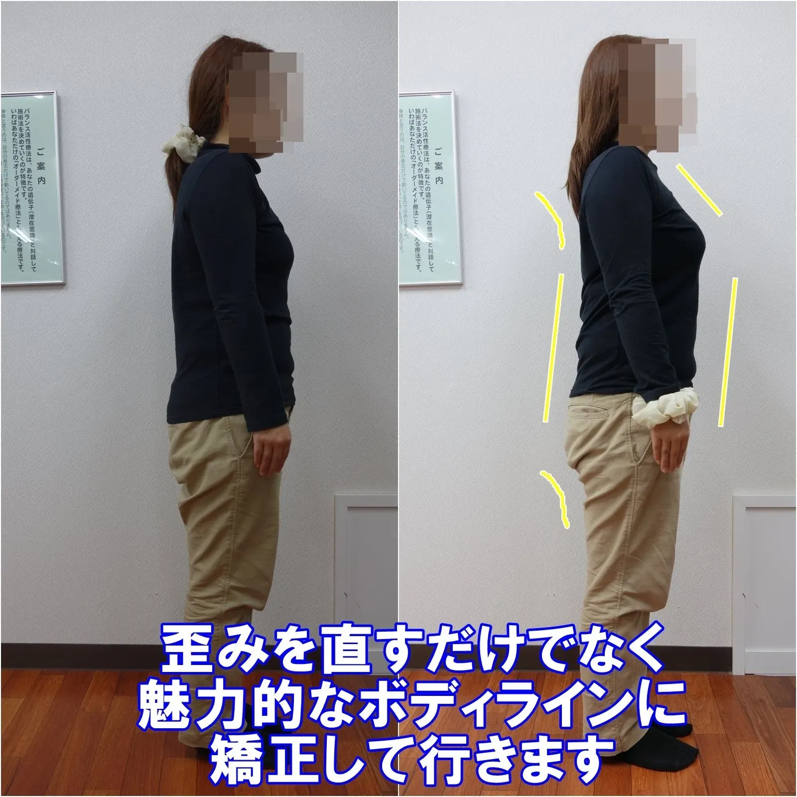 腰痛やぎっくり腰も予防する美ボディライン