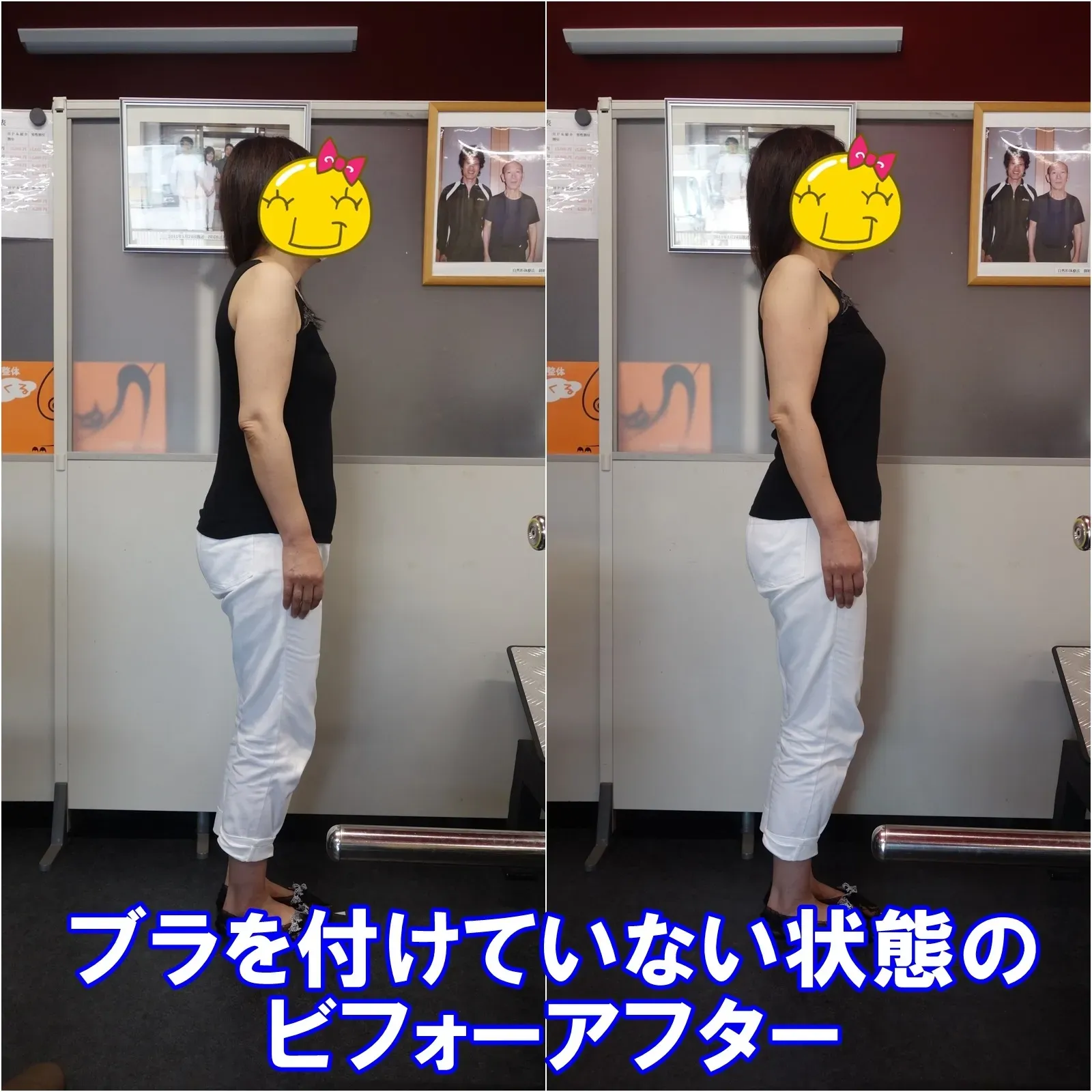 バストアップで美しい体へ