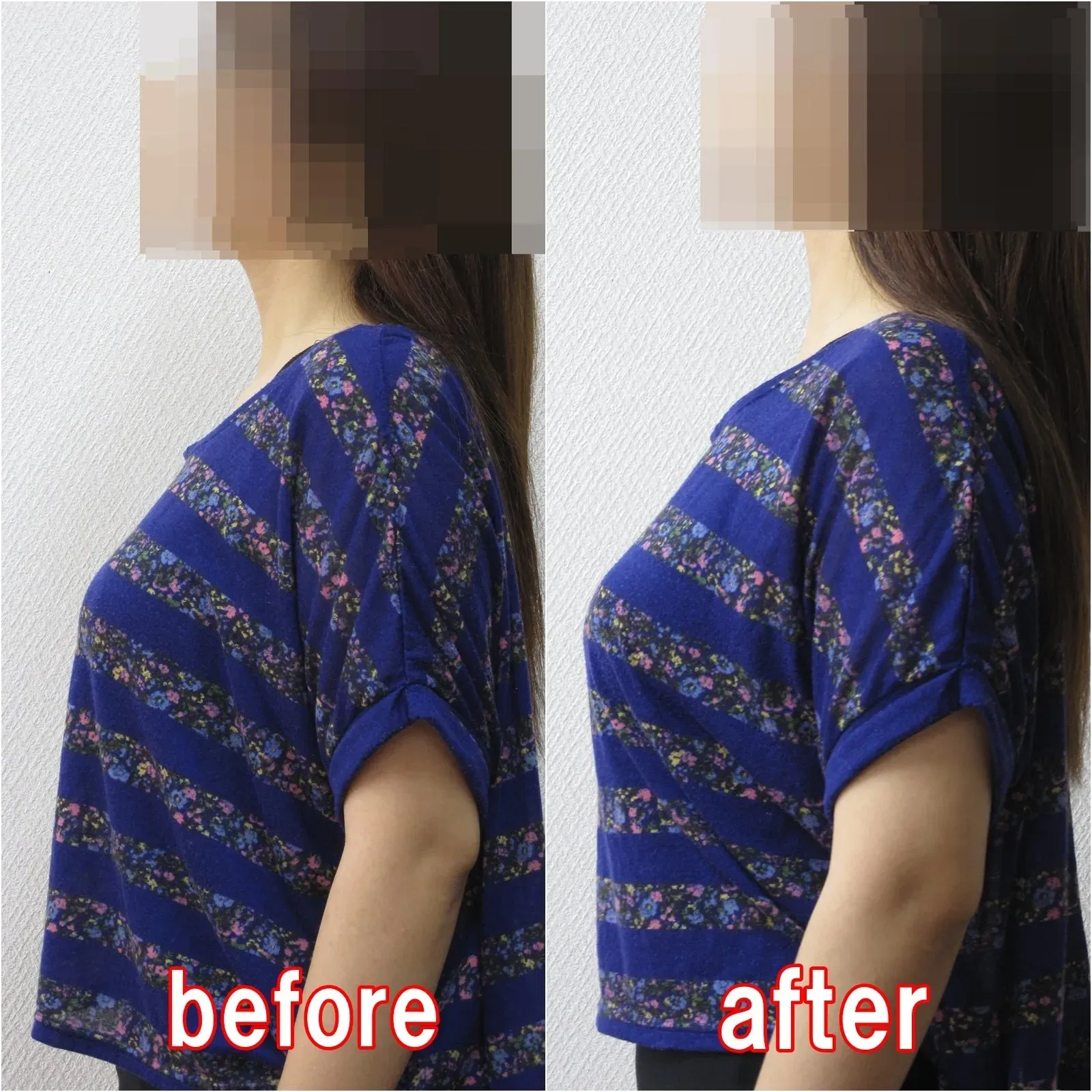 姿勢を改善することでバストアップ